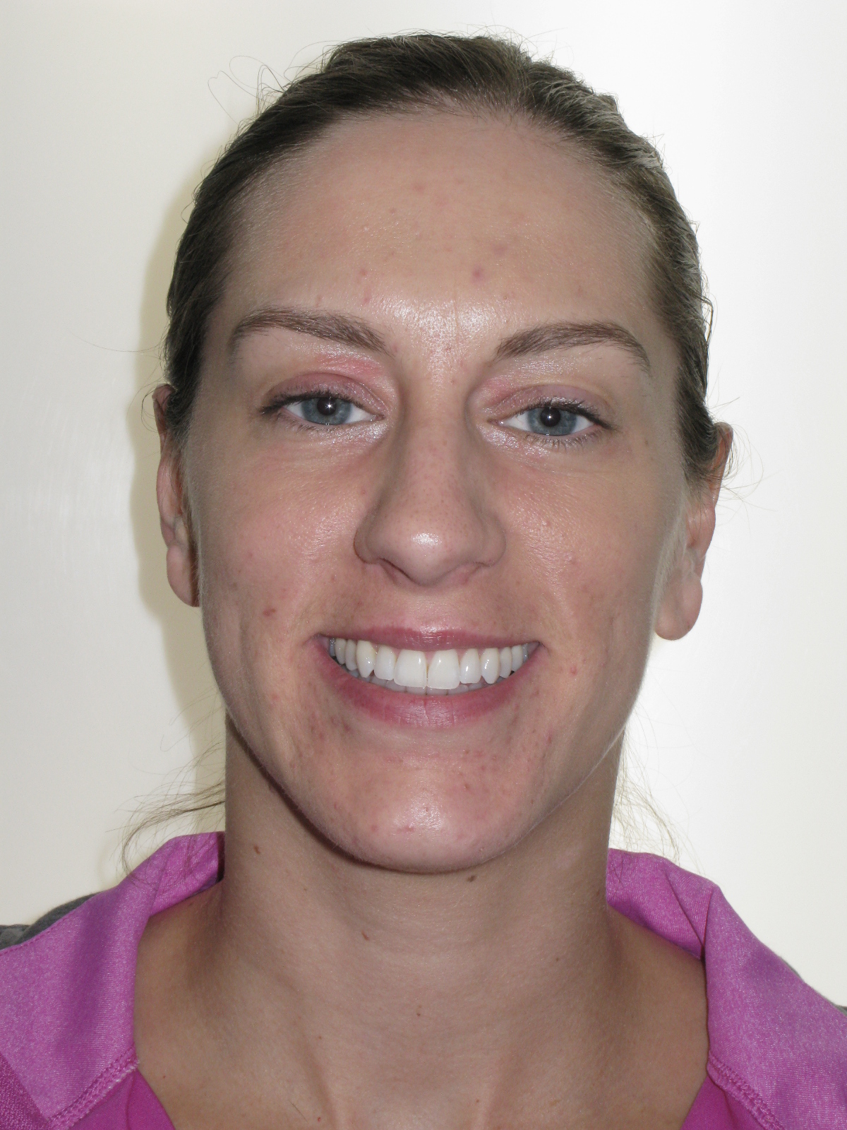 Orthodontic Treatment Case Study